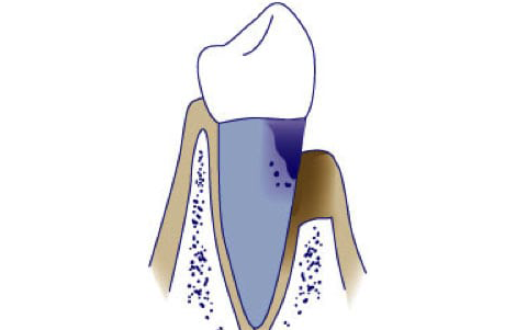 https://msdp.boostable.au/wp-content/uploads/2021/01/Image-3-1-3.png