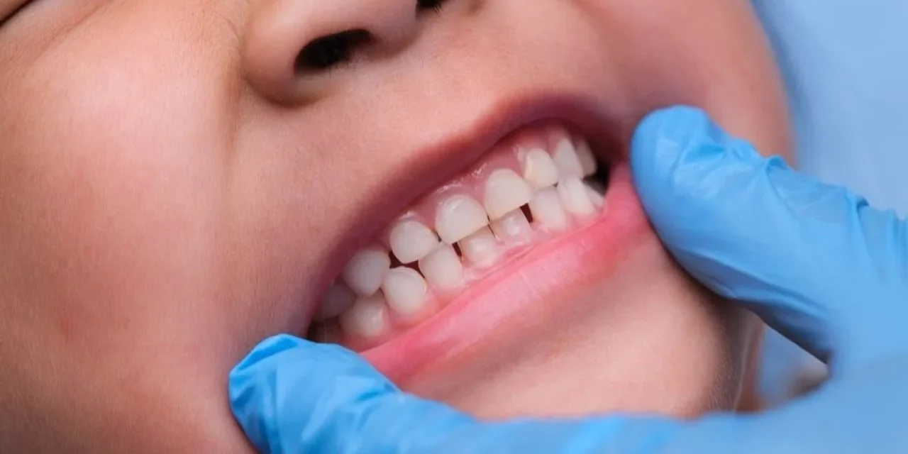 4 Important Facts About Baby Teeth That You Need To Know